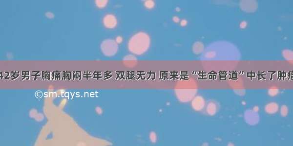 42岁男子胸痛胸闷半年多 双腿无力 原来是“生命管道”中长了肿瘤