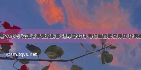 该患者术后20小时 发现患手轻度肿胀 指甲略发绀 毛细血管反应存在 针刺指尖部有鲜