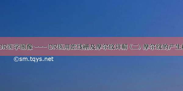 X线DR医学图像 --- DR医用滤线栅及摩尔纹详解 (二) 摩尔纹的产生机理