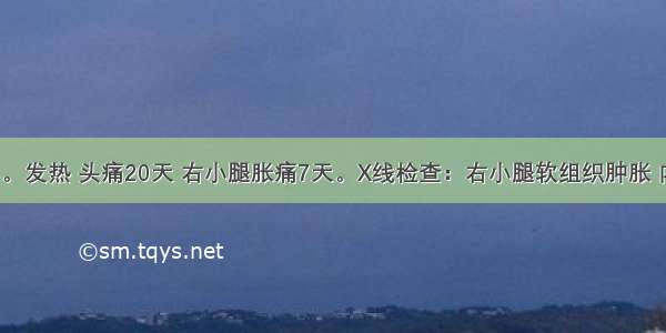 男性 12岁。发热 头痛20天 右小腿胀痛7天。X线检查：右小腿软组织肿胀 内有网状阴