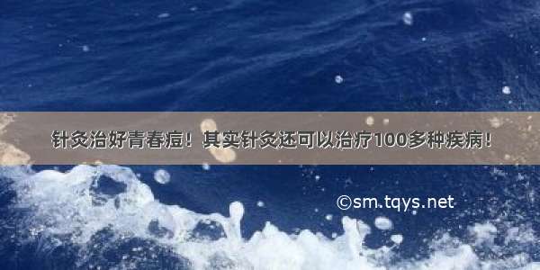 针灸治好青春痘！其实针灸还可以治疗100多种疾病！