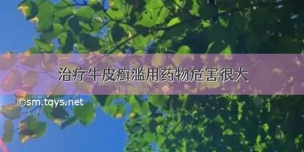 治疗牛皮癣滥用药物危害很大