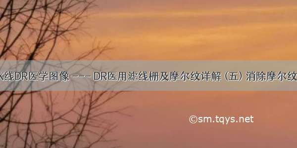 X线DR医学图像 --- DR医用滤线栅及摩尔纹详解 (五) 消除摩尔纹