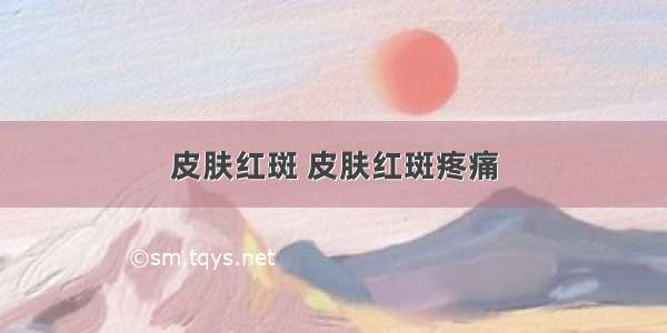 皮肤红斑 皮肤红斑疼痛