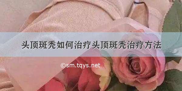 头顶斑秃如何治疗头顶斑秃治疗方法