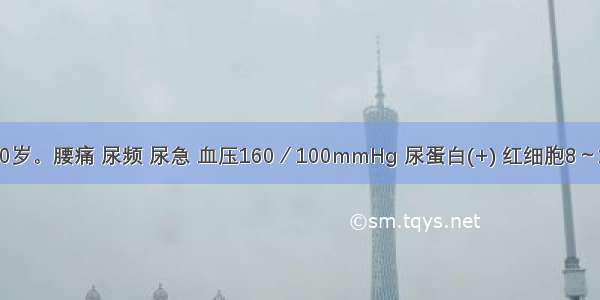 患者 女 30岁。腰痛 尿频 尿急 血压160／100mmHg 尿蛋白(+) 红细胞8～10个／HP