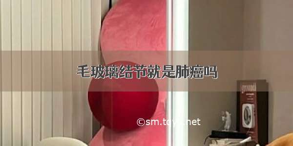 毛玻璃结节就是肺癌吗